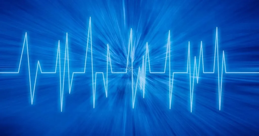 EKG-Kurve eines Herzschlags